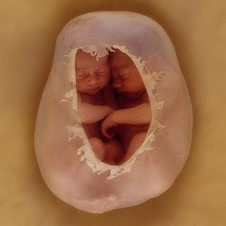 Resultado de imagen de embarazo gemelar