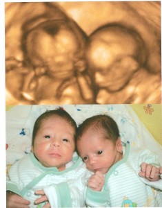 Hermanos mellizos